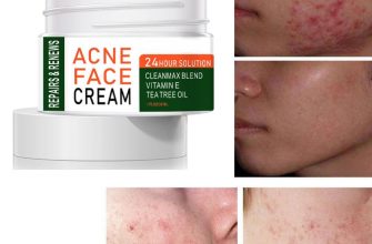 chaynoe derevo ot akne kak ispolzovat 1