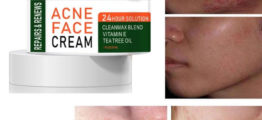 chaynoe derevo ot akne kak ispolzovat 1