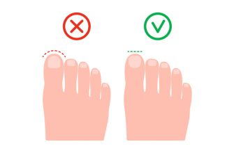 gigiena nog kak pravilno uhazhivat za stopami