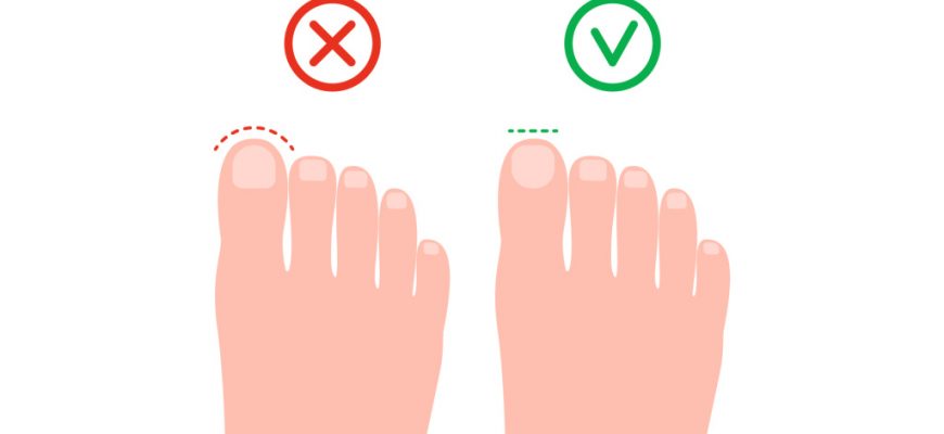 gigiena nog kak pravilno uhazhivat za stopami