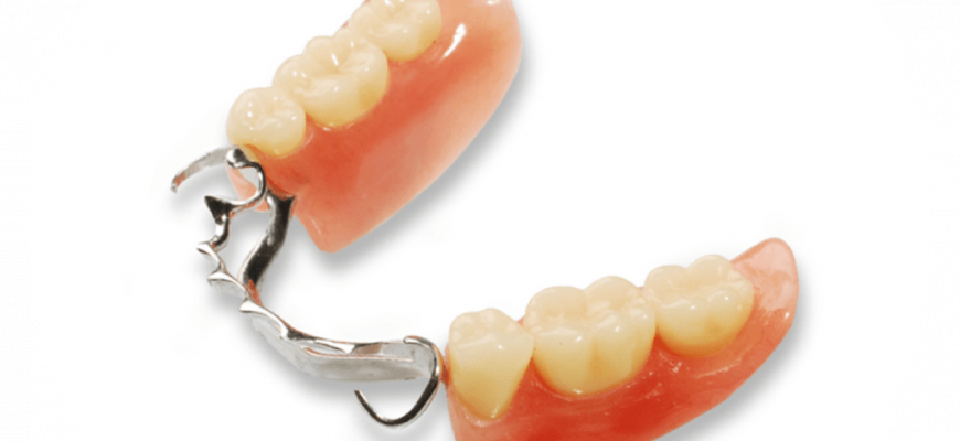 kak pravilno uhazhivat za zubami posle otbelivaniya