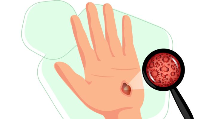 uhod za kozhey rasprostranennye oshibki i kak ih izbezhat